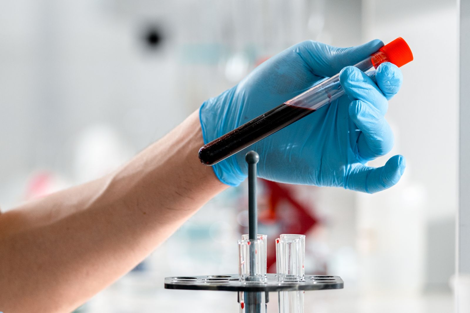 Behandschuhte Hand hält ein Röhrchen mit Blutprobe über einem Probenständer im Labor